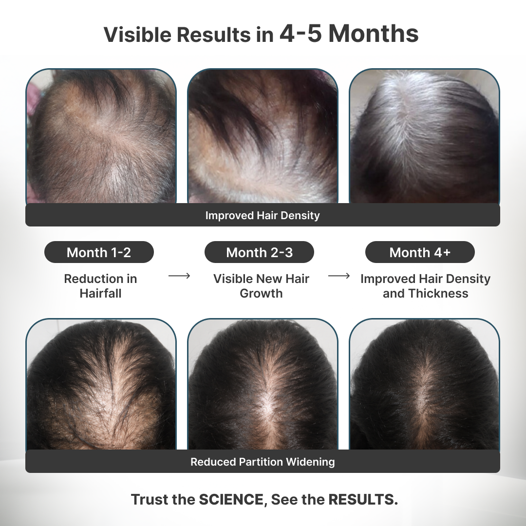 Female Foundation: Advanced Hair Growth Kit