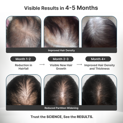 Female Foundation: Advanced Hair Growth Kit