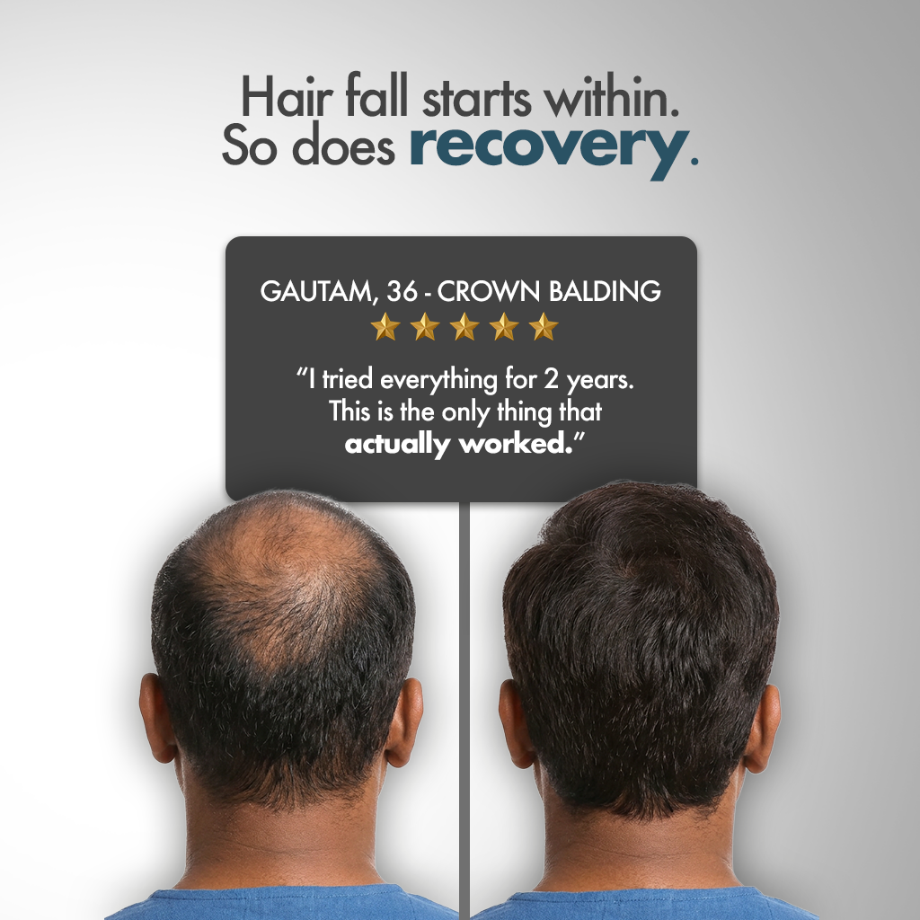 Hair Fact- Your Complete Supplement Kit