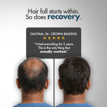 Hair Fact- Your Complete Supplement Kit