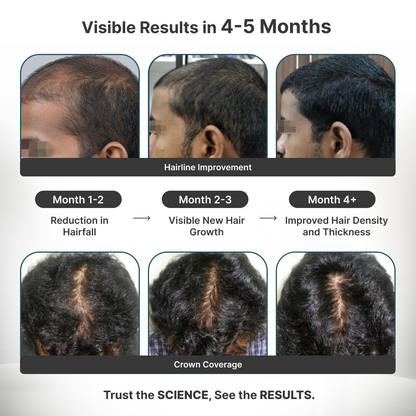 Reset: Active Hair Growth Kit